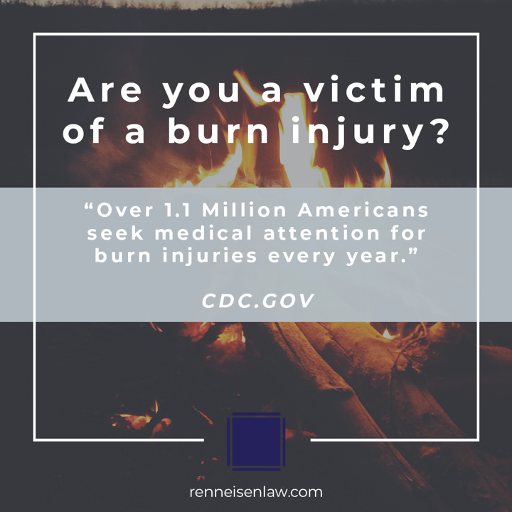 Read more about the article Are you a victim of a burn injury?
